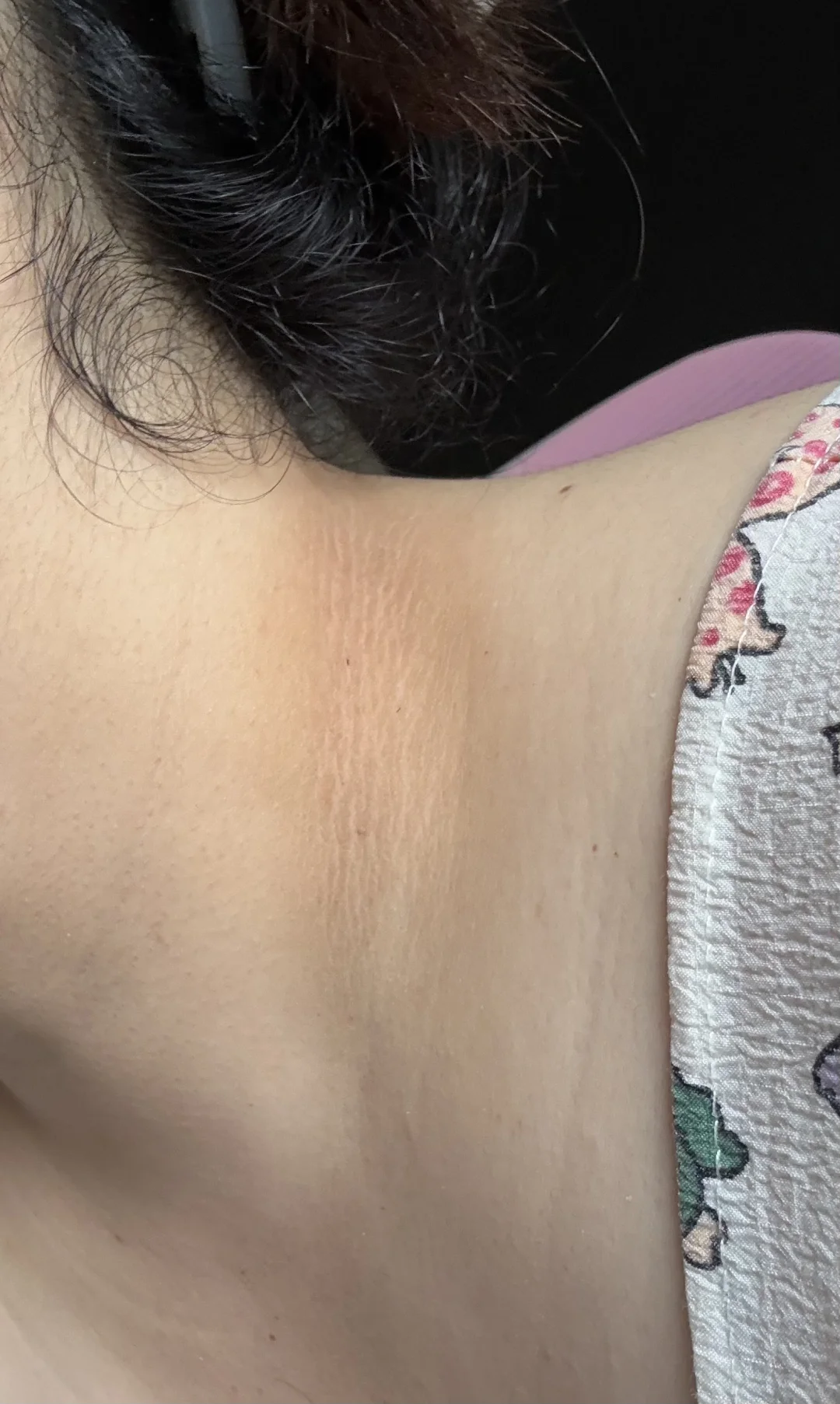 这是胰岛素抵抗吗？？