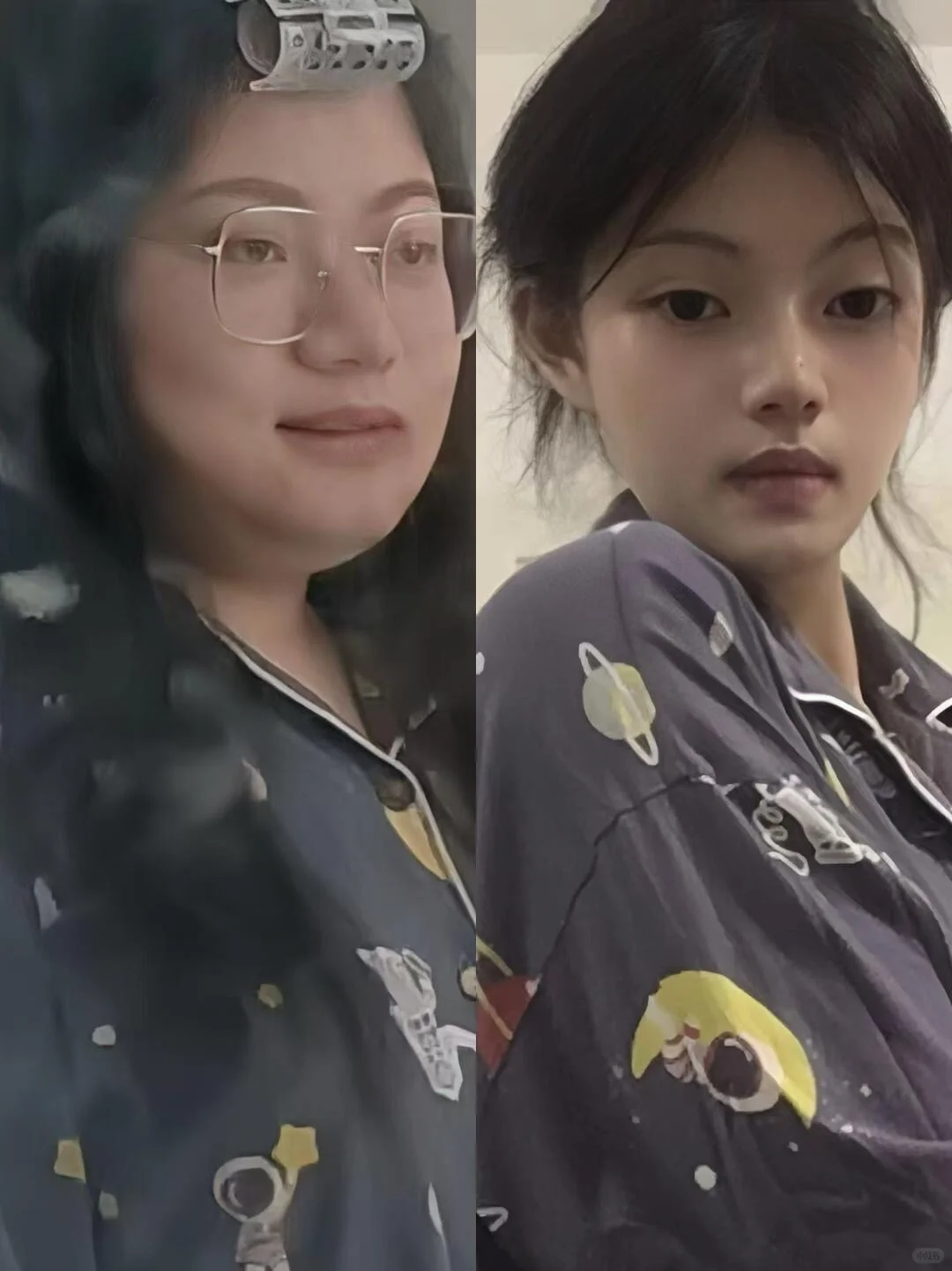 胰岛素抵抗瘦100斤,多囊上岸教程!