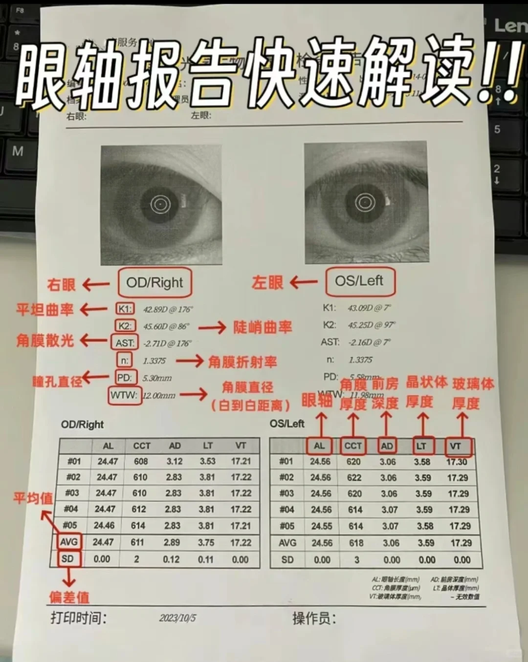 近视，度数，眼轴都懂了。