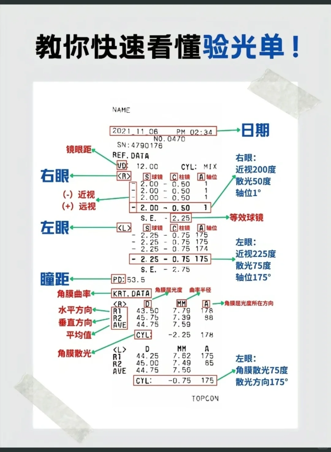 近视，度数，眼轴都懂了。