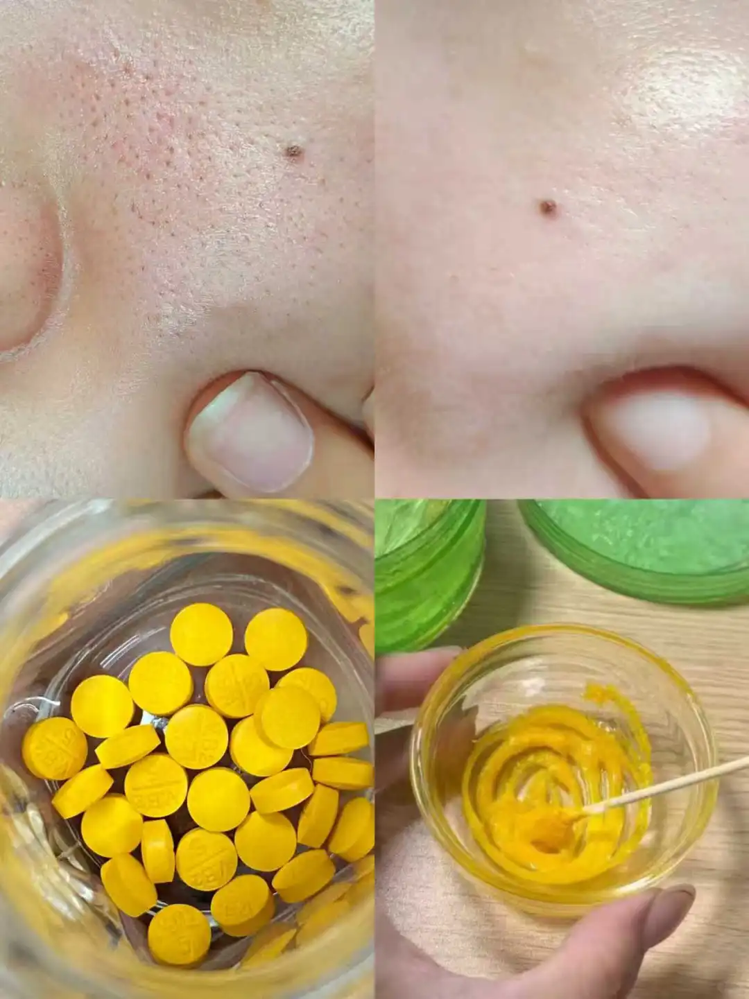 发现一个怪异但巨能缩的方法（糙脸）