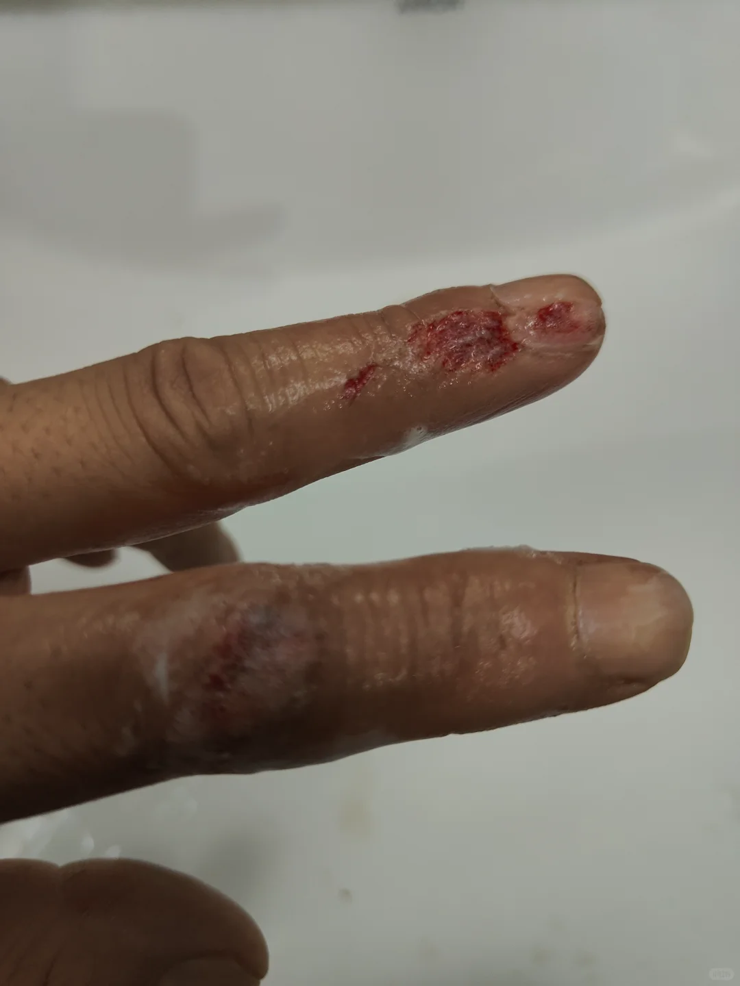 角磨机的风险系数，我中招了，时刻注意吧！