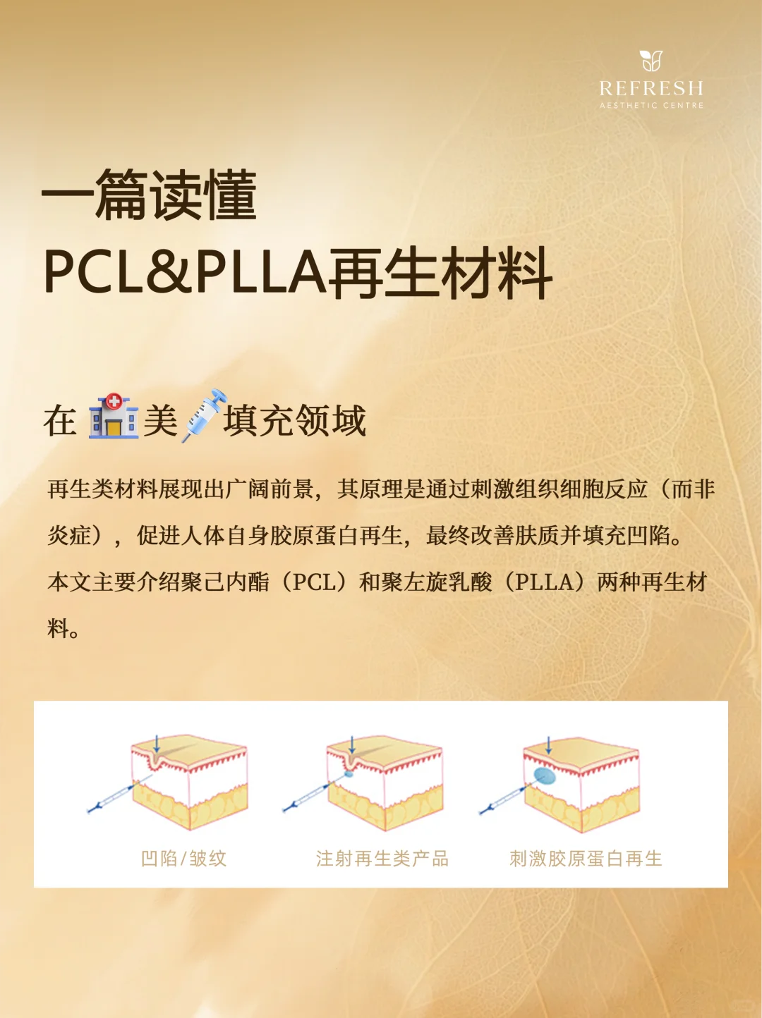 再生材料PCL、PLLA到底是什么？一篇看懂！