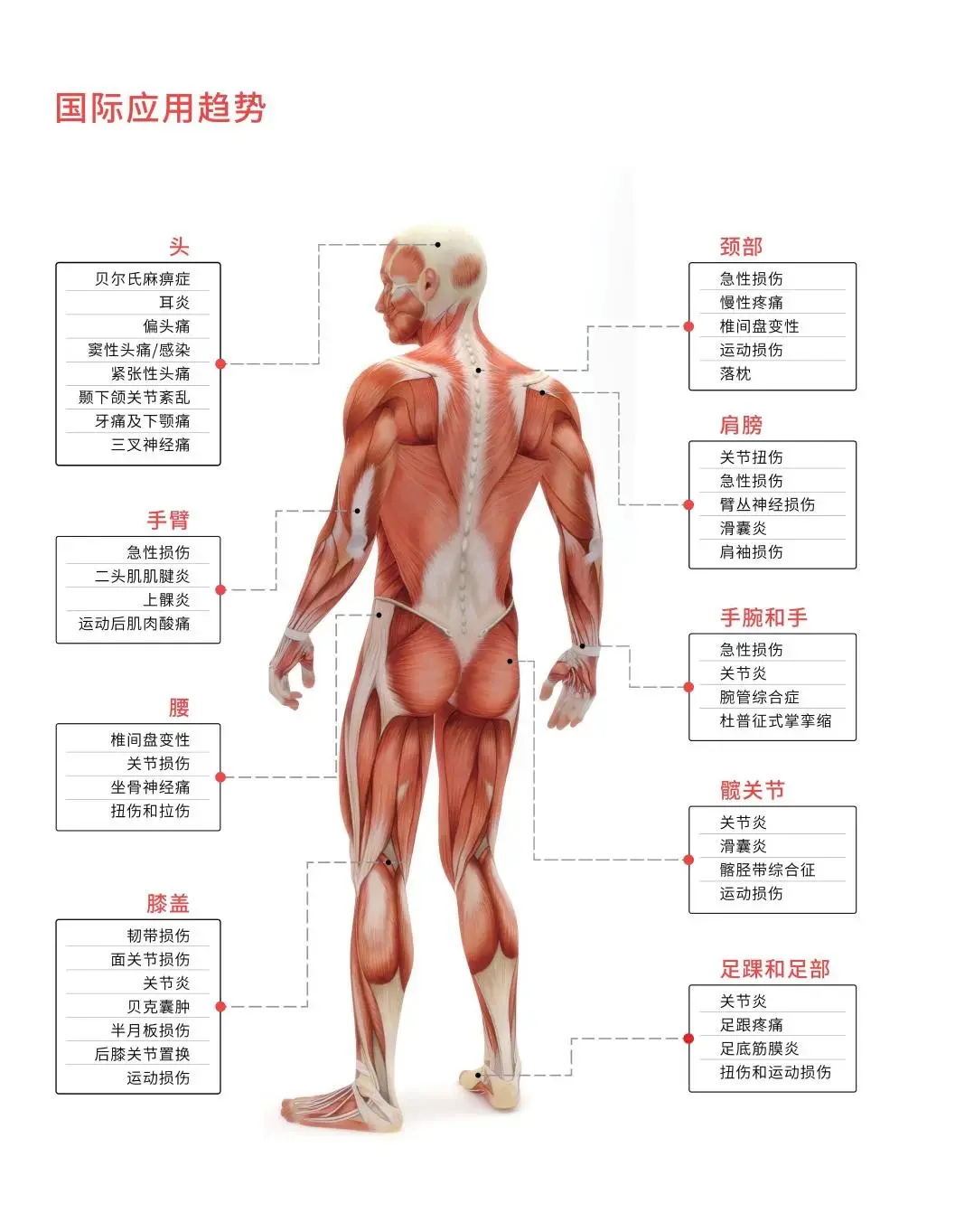 疼痛好帮手——物理治疗—-高能量激