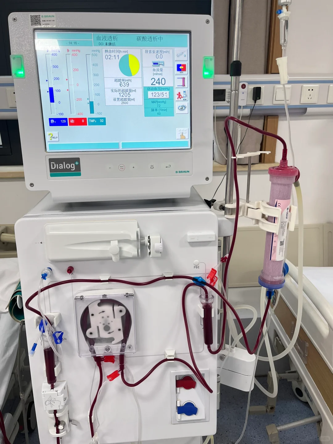 血液透析机器