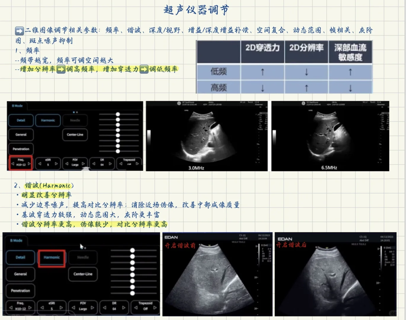 终于学会了超声仪器调节！！！