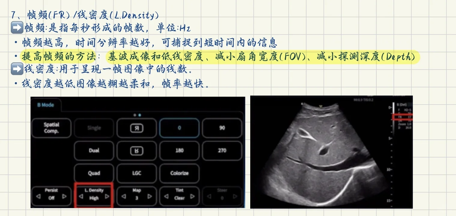 终于学会了超声仪器调节！！！