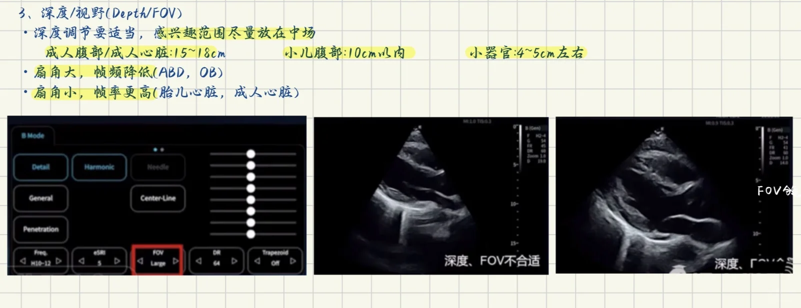 终于学会了超声仪器调节！！！