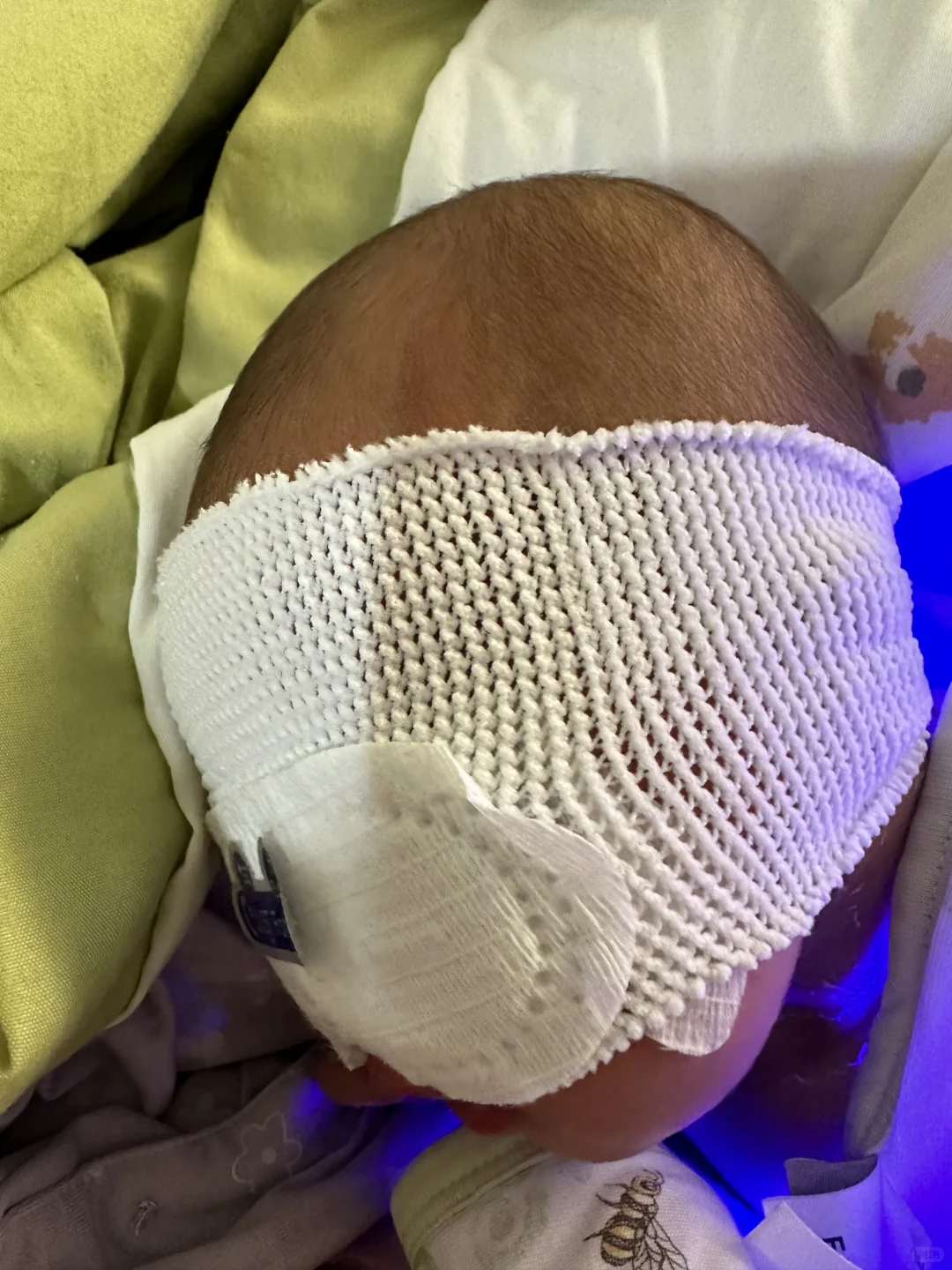 医小租-蓝光毯黄疸检测仪打卡第一天