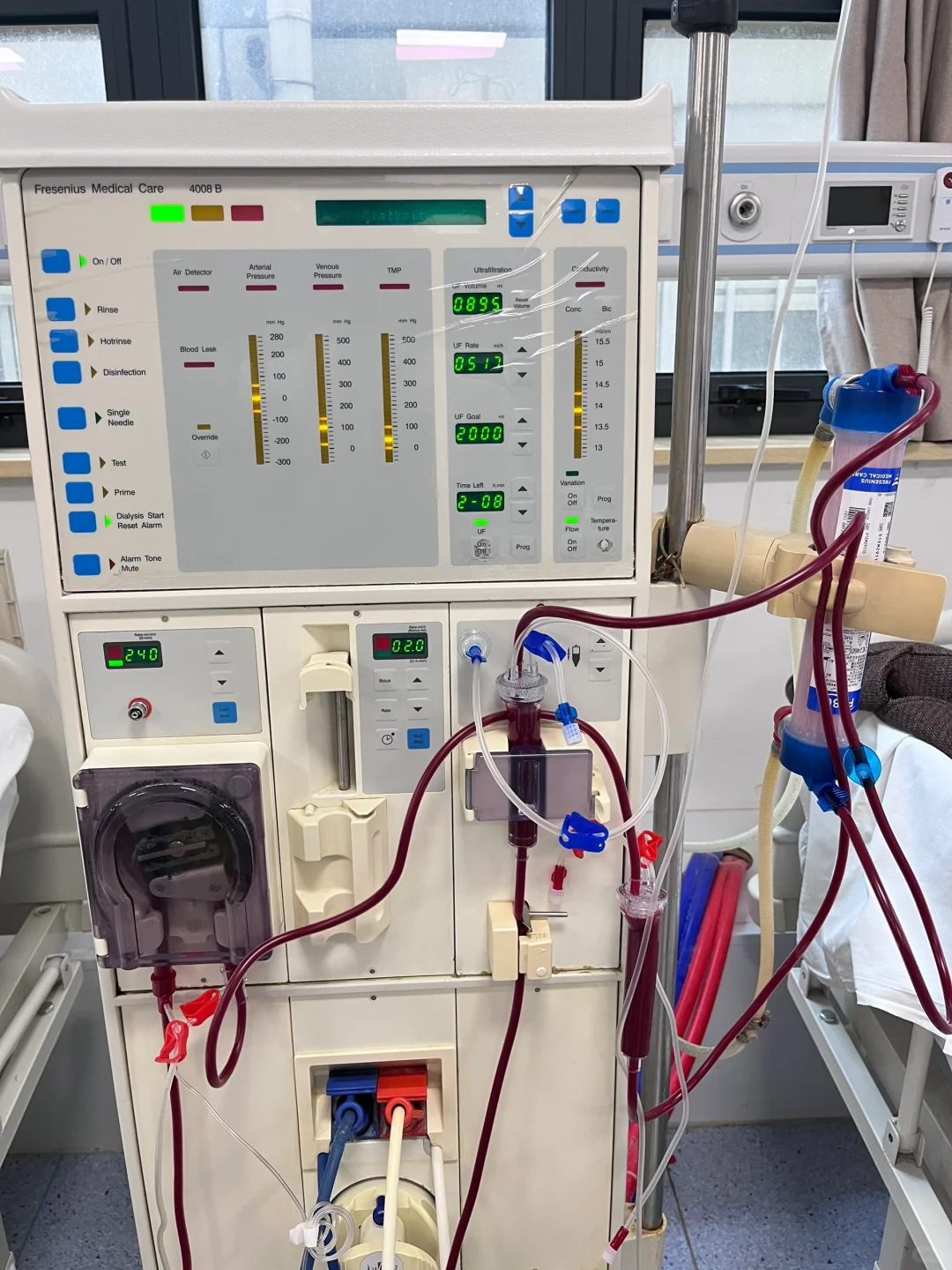 血液透析机器