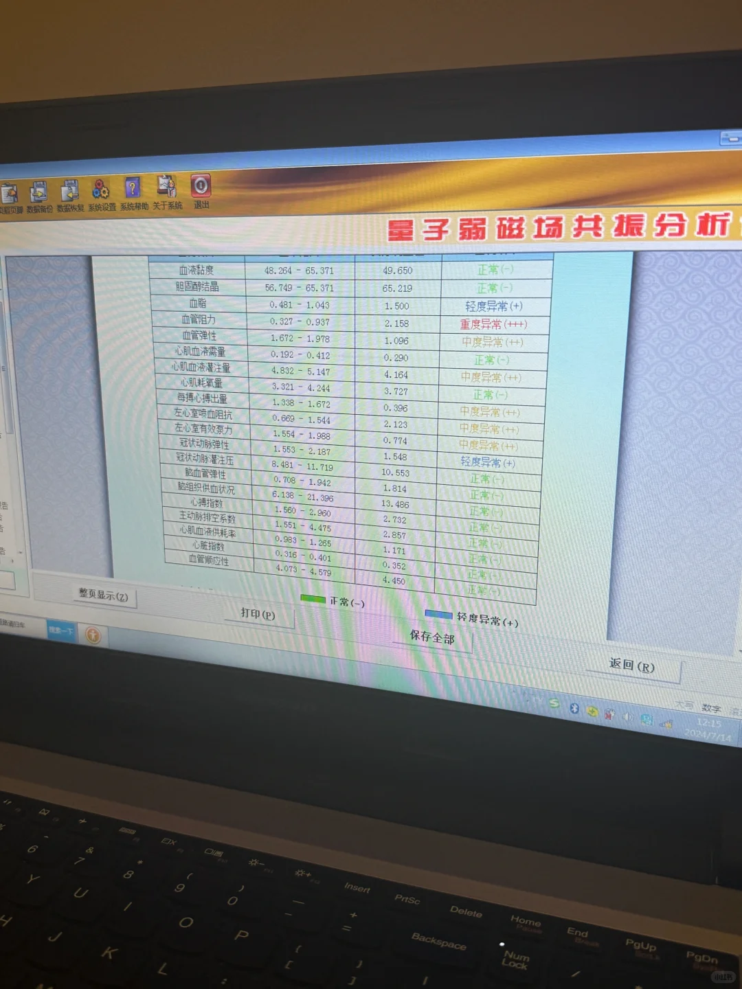 哇哦 量子弱磁场共振好神奇