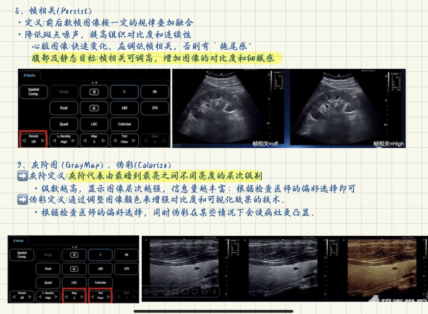 终于学会了超声仪器调节！！！
