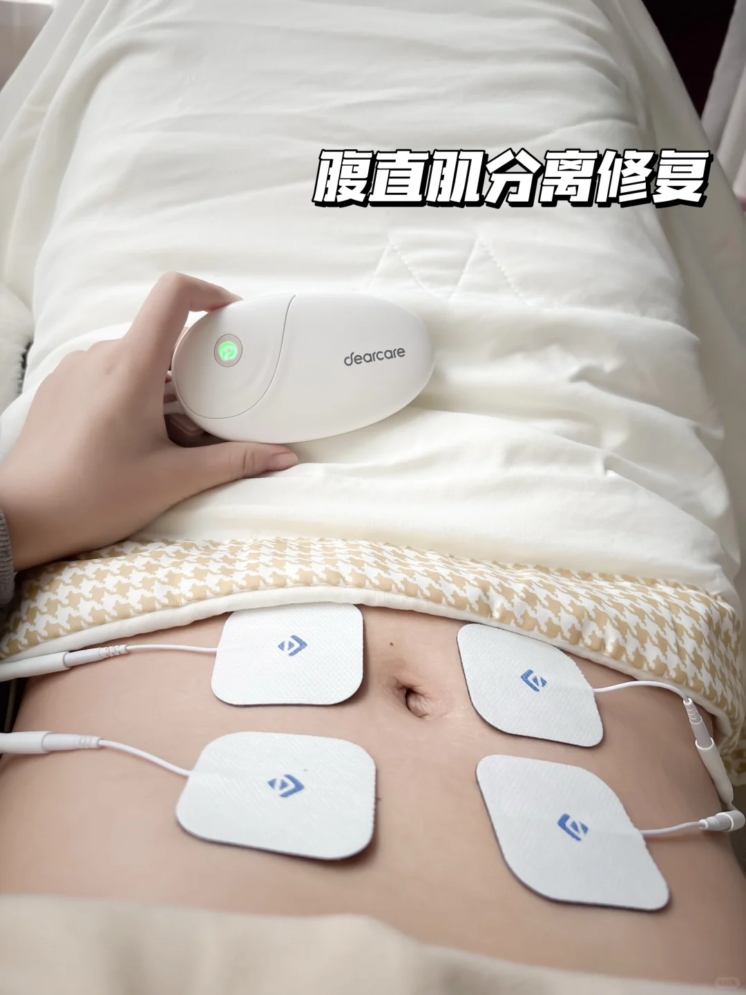 产后漏尿肚大别硬扛!家用修复仪找回掌控感