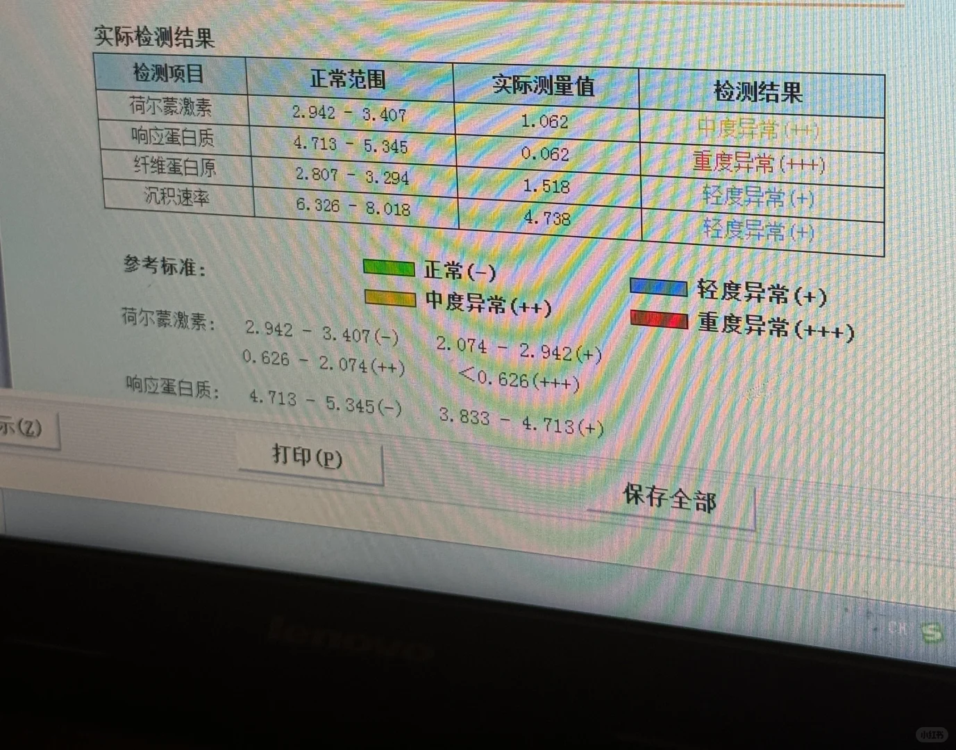 哇哦 量子弱磁场共振好神奇