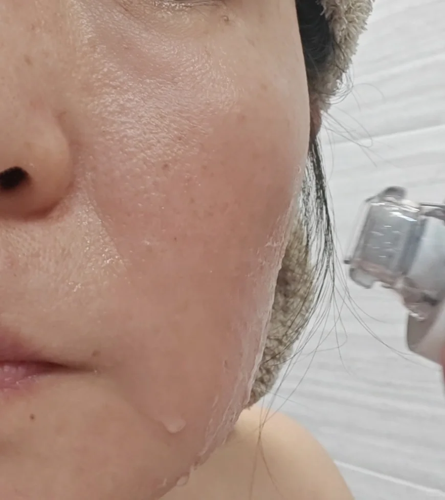 极萌水光仪初体验