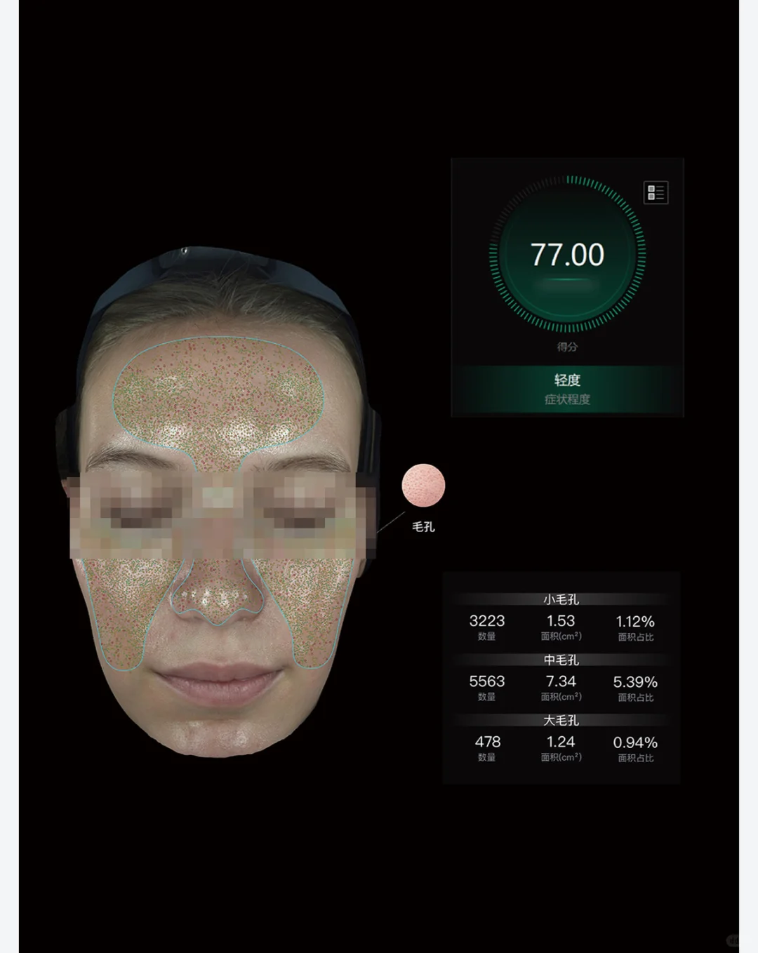 护肤小白第一次做3D皮肤检测，结果被惊到了…