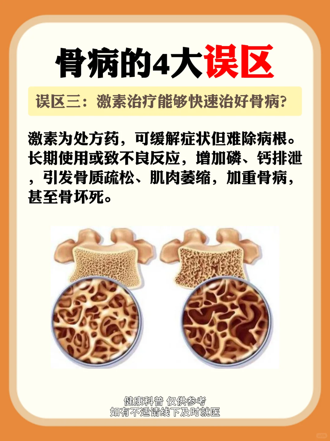 骨病的四大误区,你知道几个?
