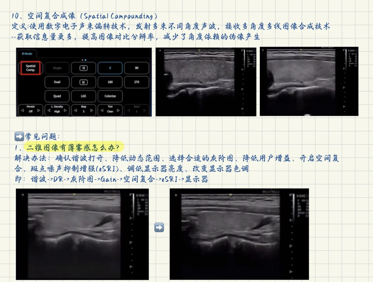 终于学会了超声仪器调节！！！