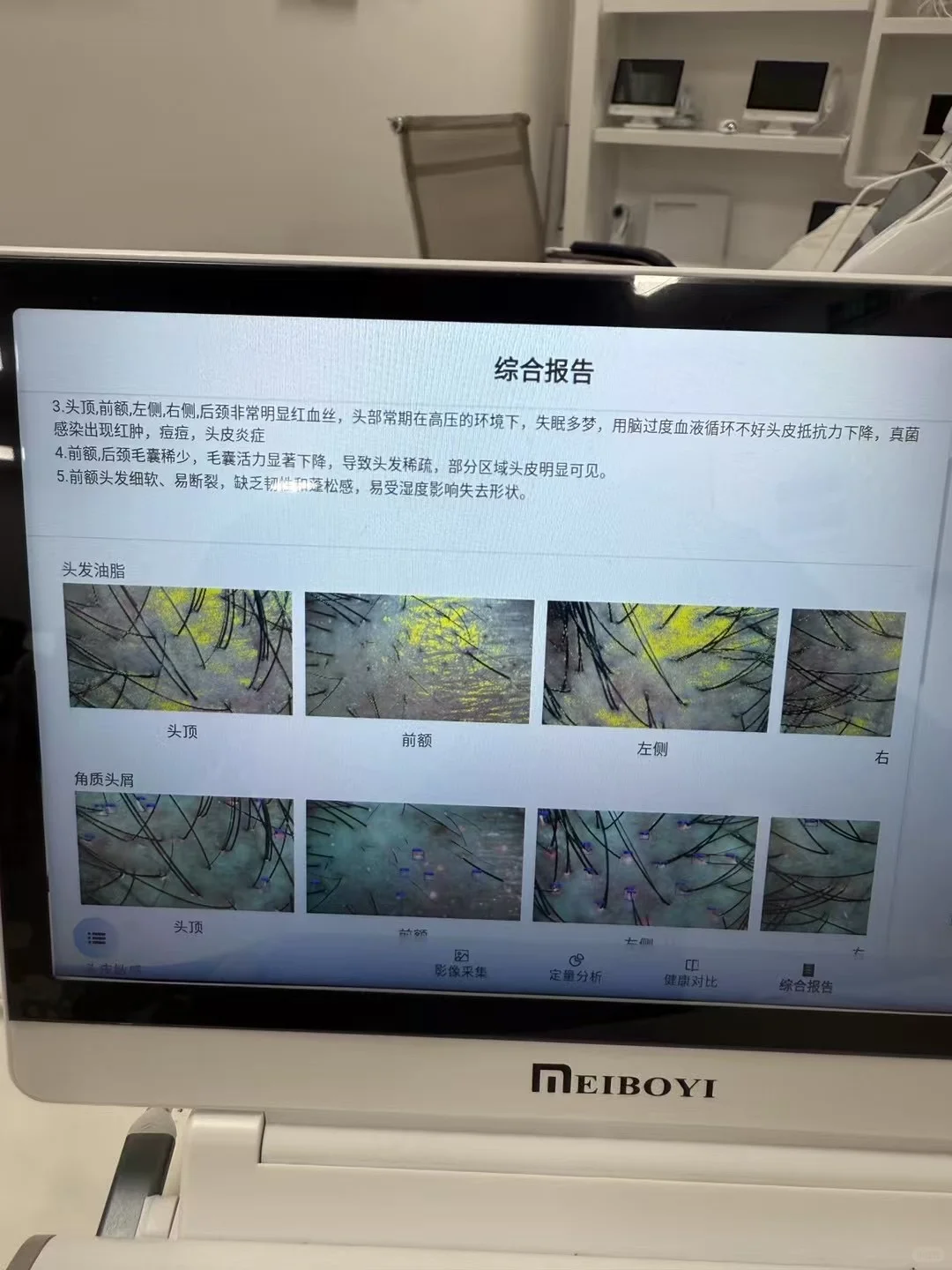 出一台AI智能头皮检测仪