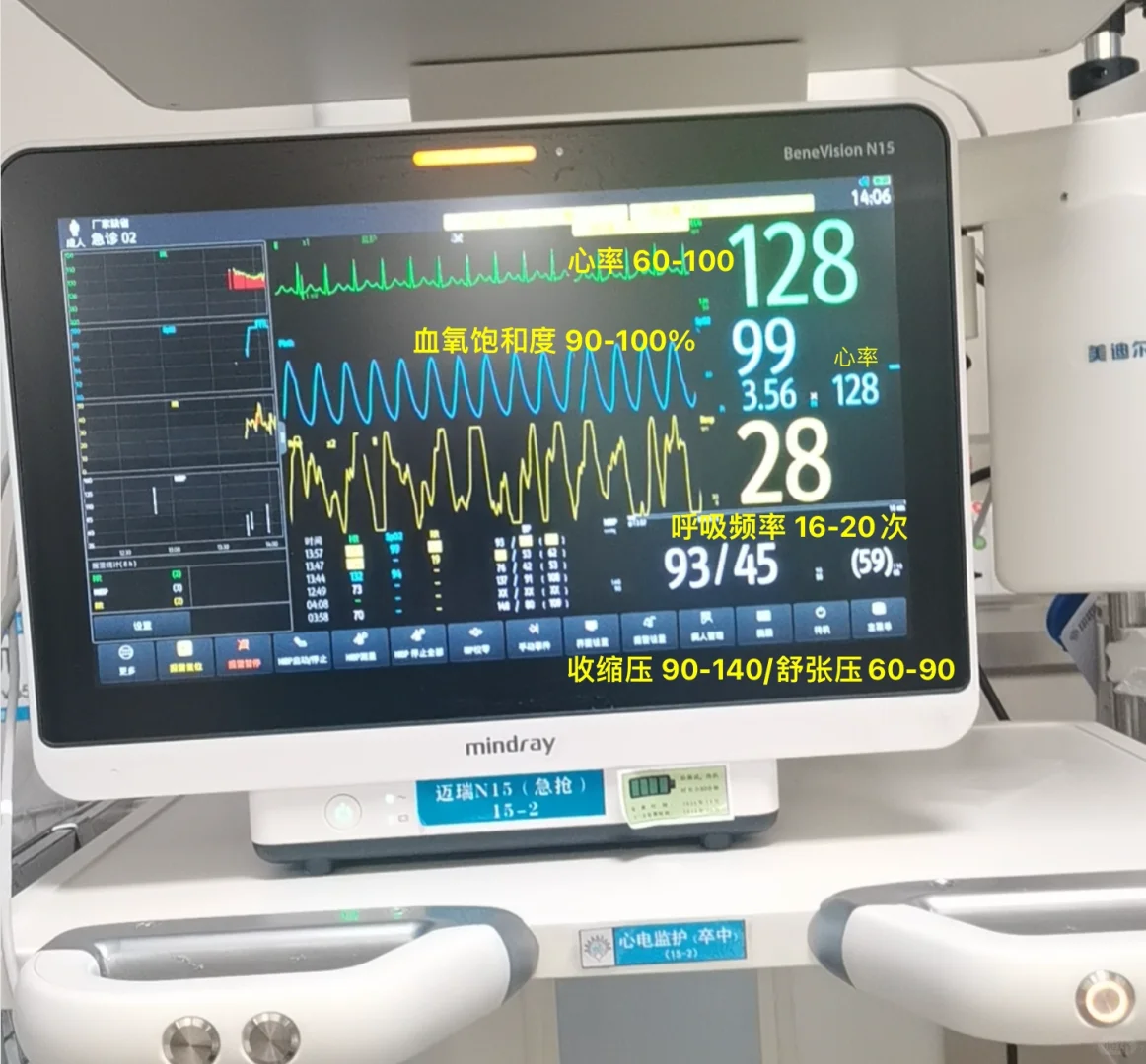 一张图教你学会看监护仪