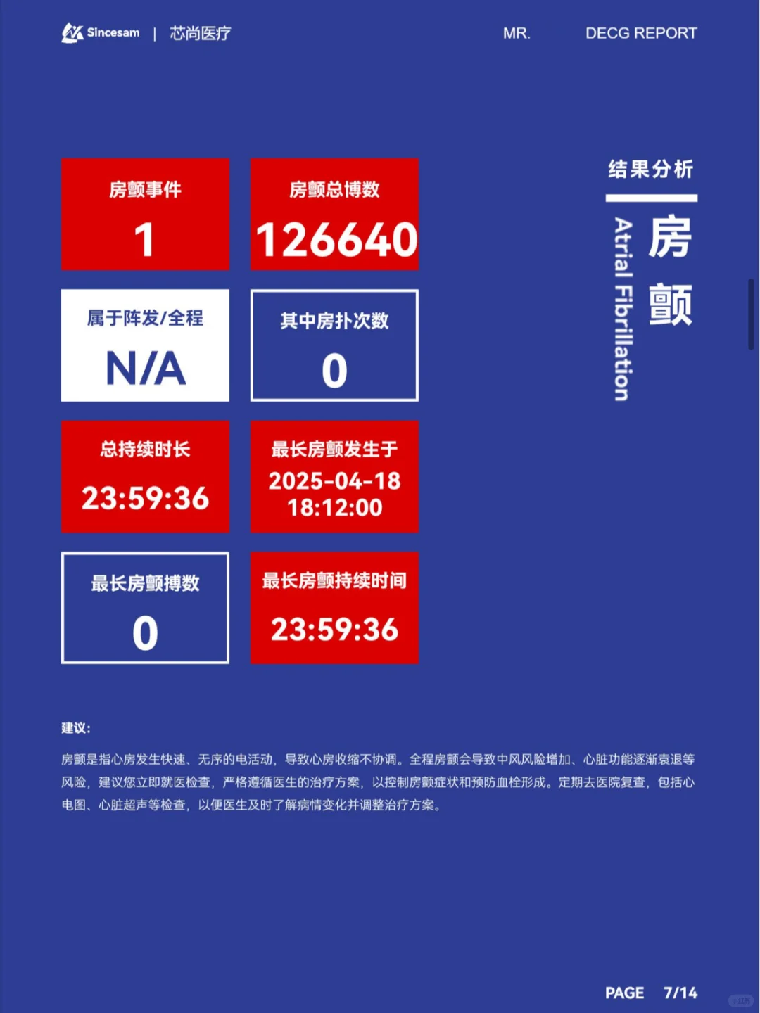 MagicPulse动态心电记录仪非常好用