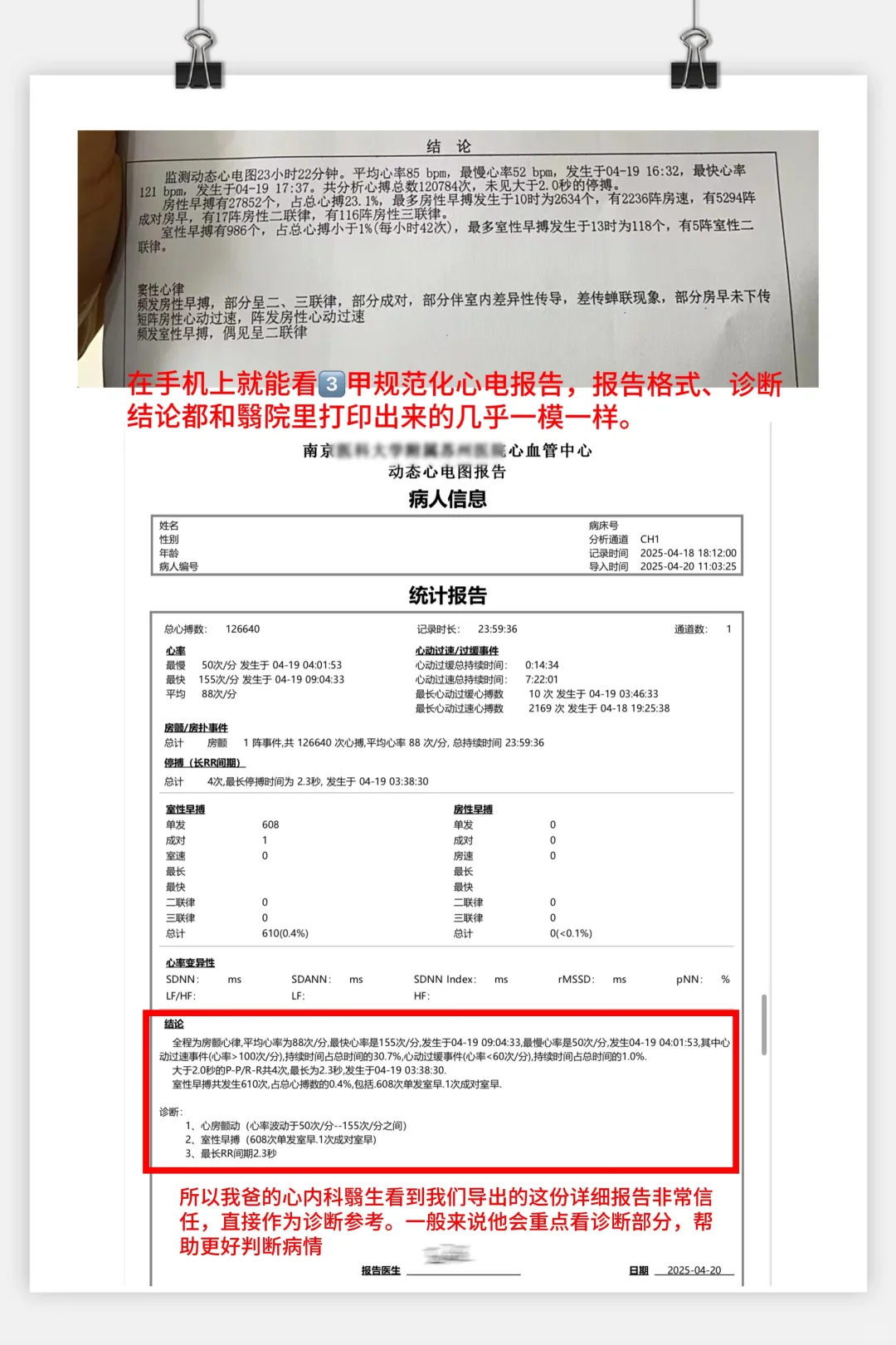 MagicPulse动态心电记录仪非常好用