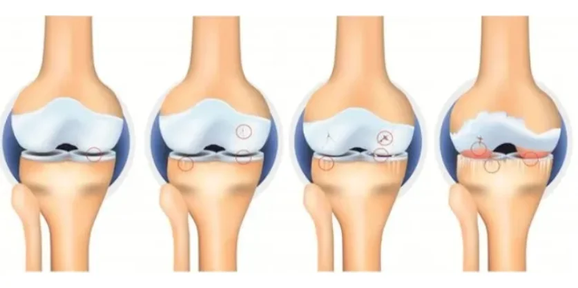 康复“神器”——多关节等速训练与评估系统