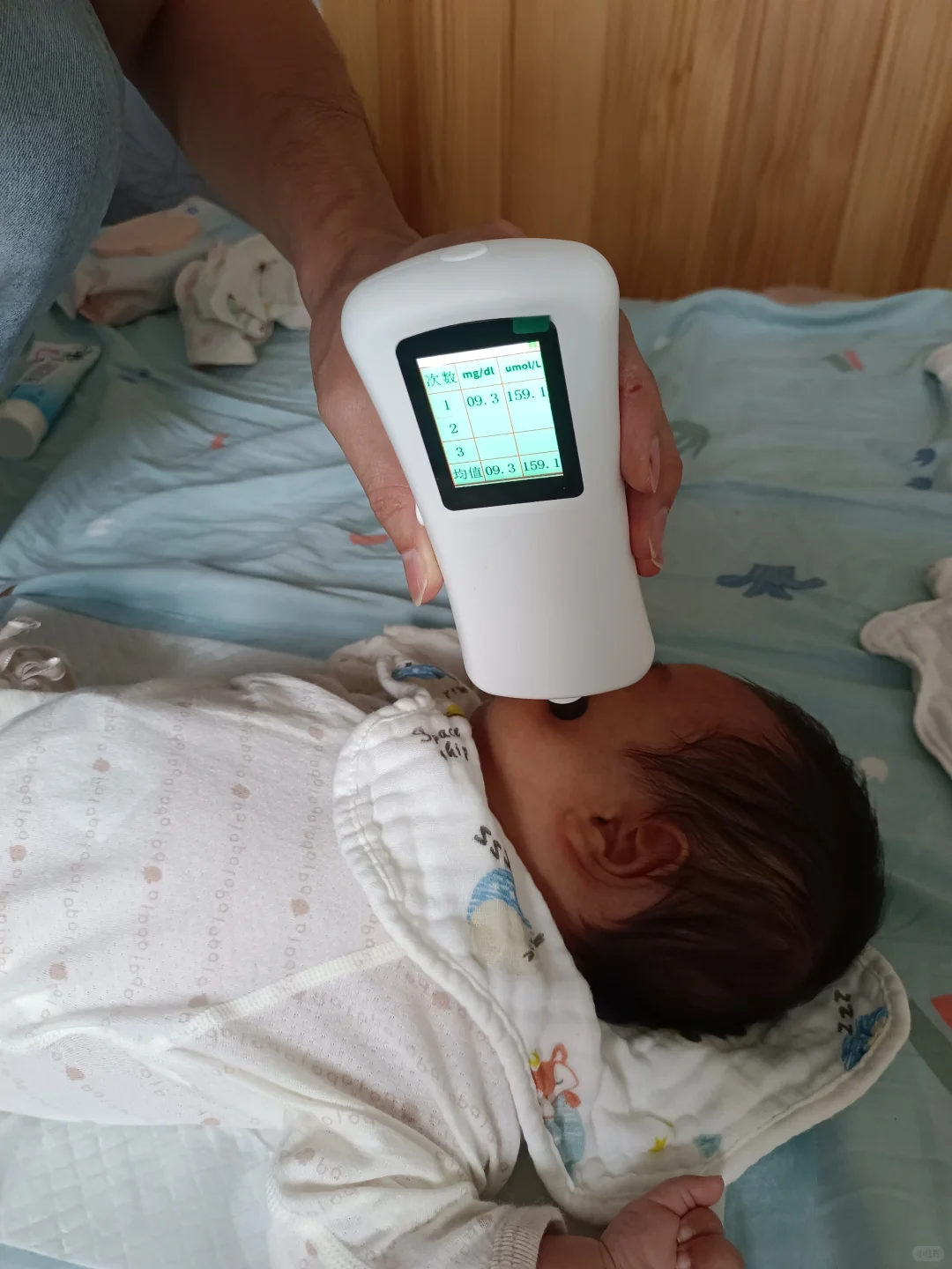 #蒂优兰黄疸检测仪