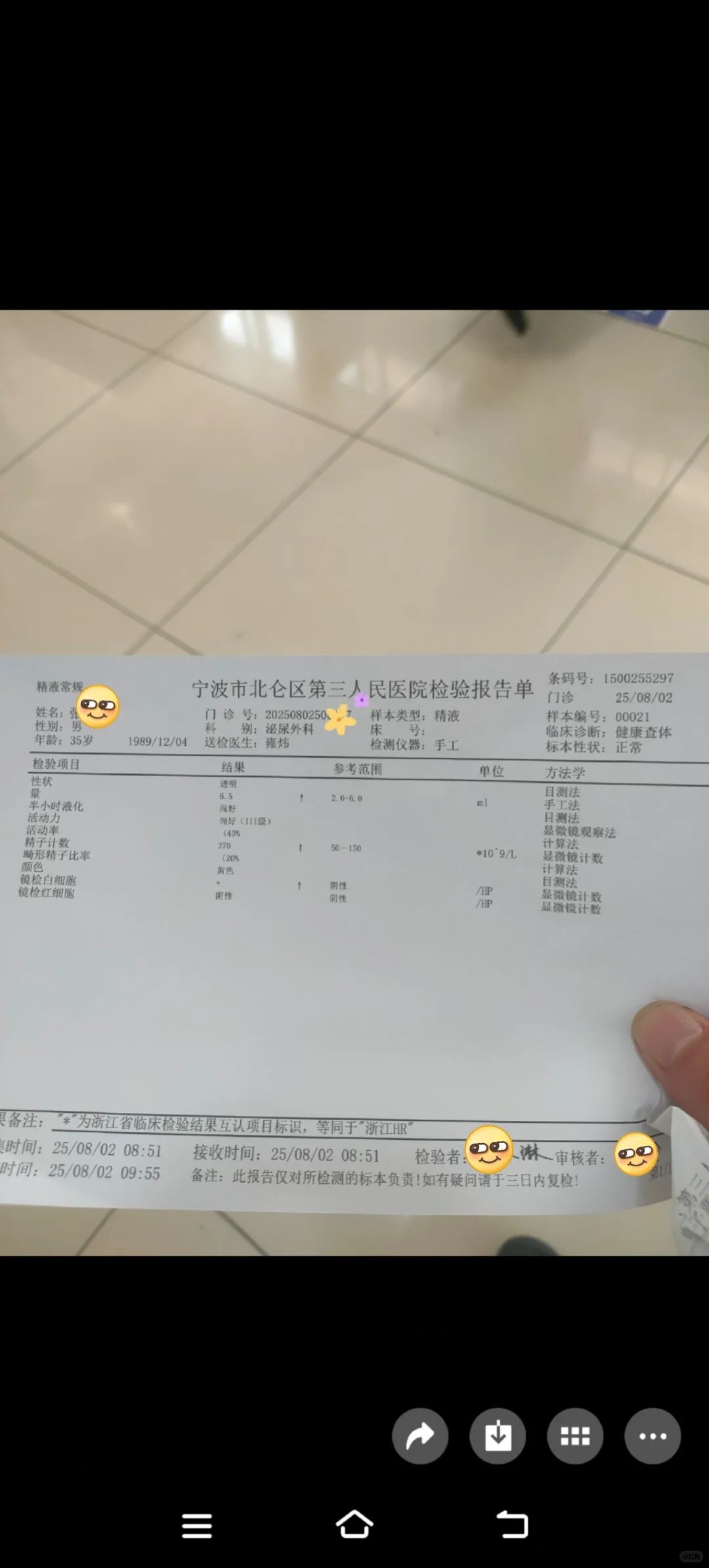 手工检测精液常规报告单