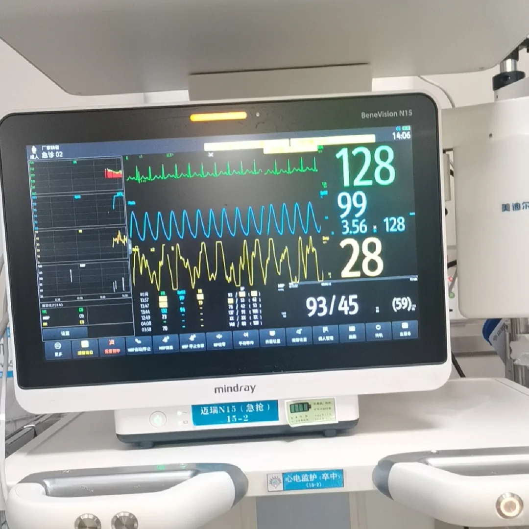 一张图教你学会看监护仪