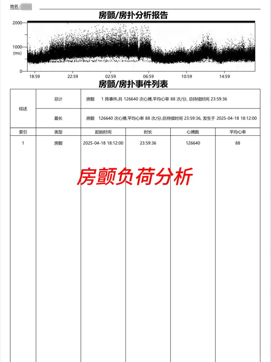 MagicPulse动态心电记录仪非常好用