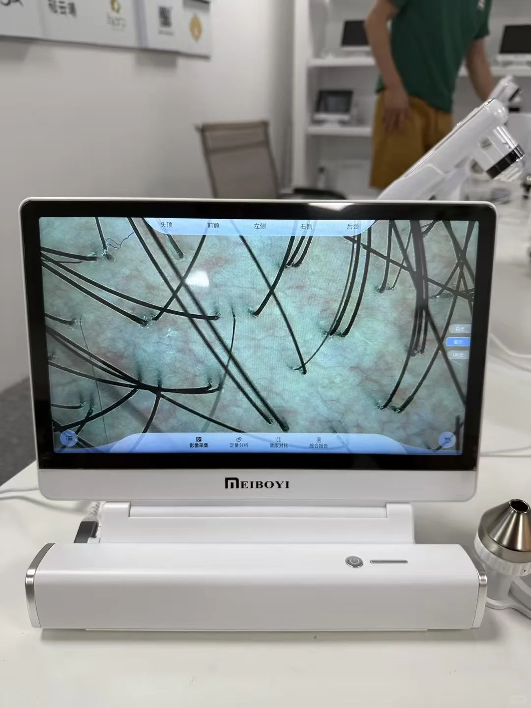 出一台AI智能头皮检测仪