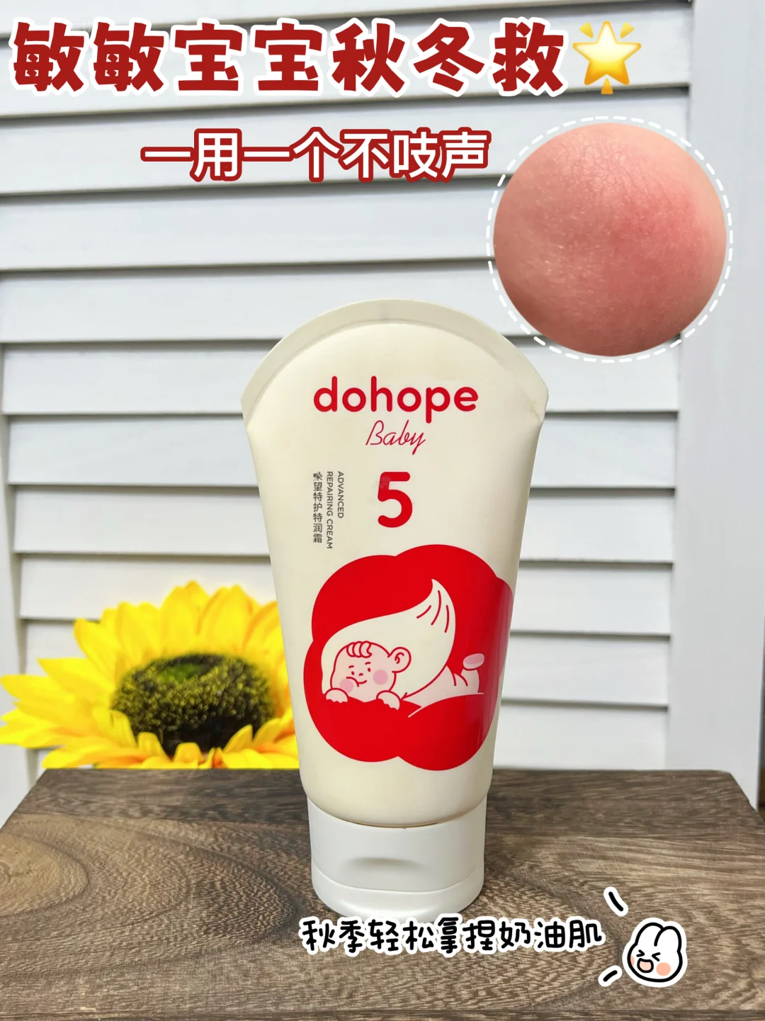 秋冬换季宝宝反复红脸的看过来?