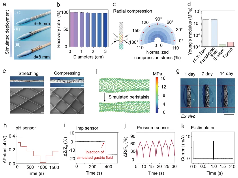 胃食管反流病实时管理无创闭环生物电子支架
