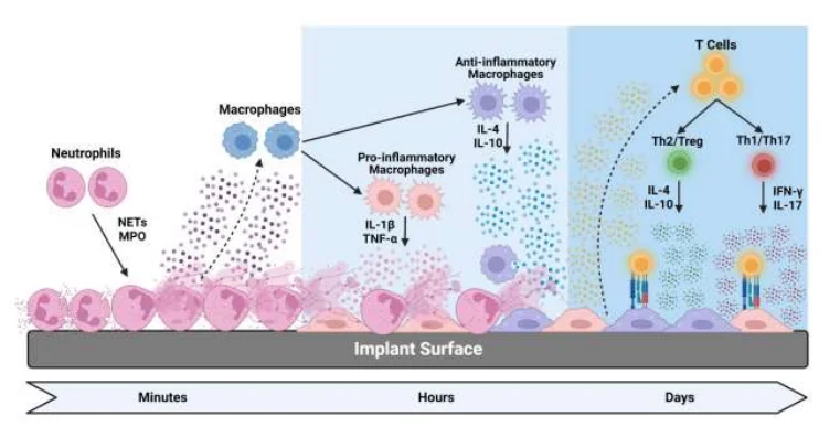不同生物材料成分引发不同免疫细胞反应