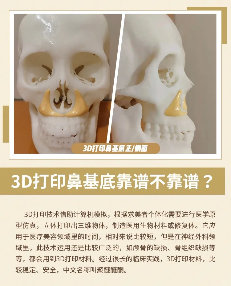 3D打印鼻基底