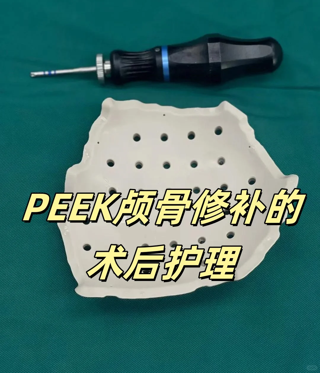 PEEK颅骨修补的术后护理有哪些