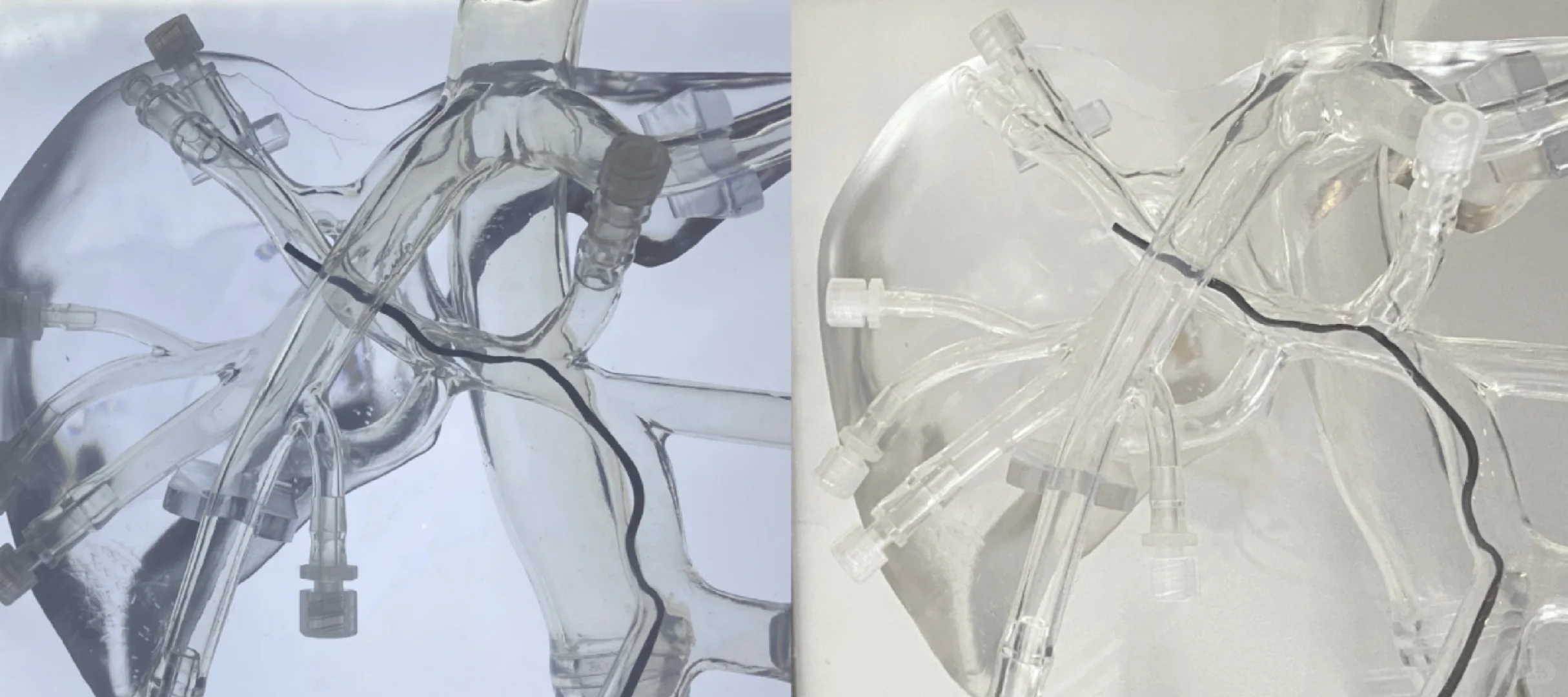 德为医疗智能化血流平台