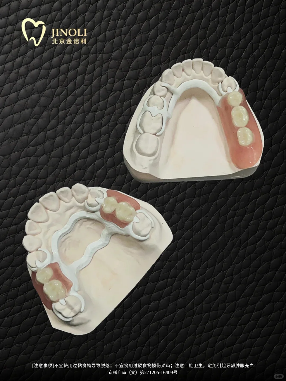 支架假牙中的战斗机-peek支架假牙!