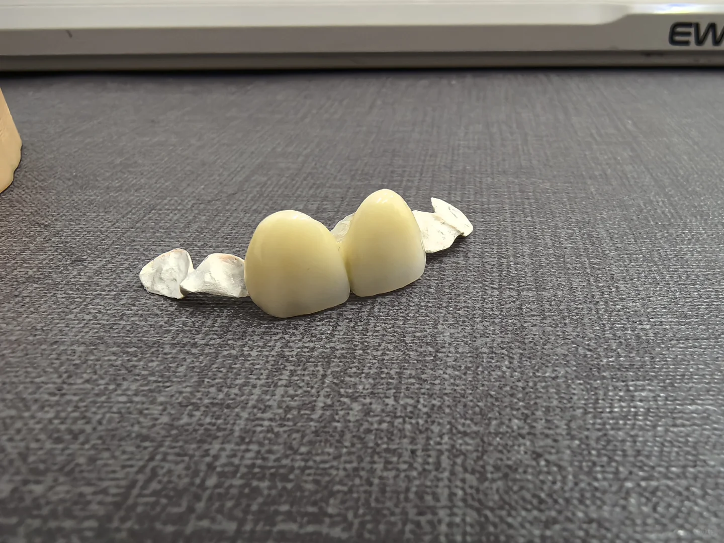 ?假牙带翅膀，多不多余？