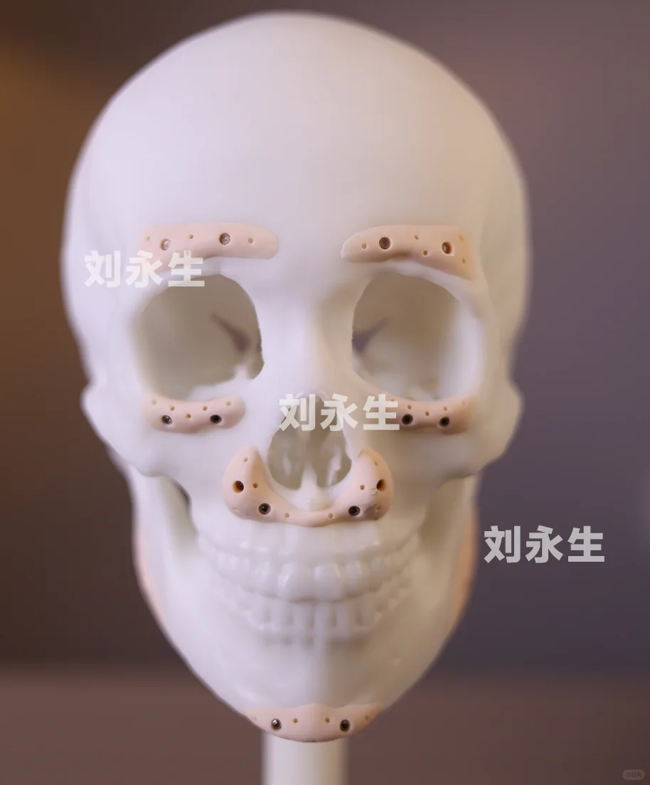 3D如何打印鼻基底，面诊前一定要做的功课