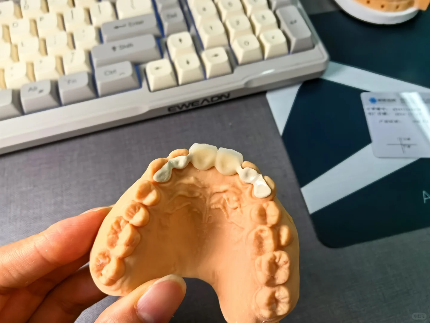 ?假牙带翅膀，多不多余？