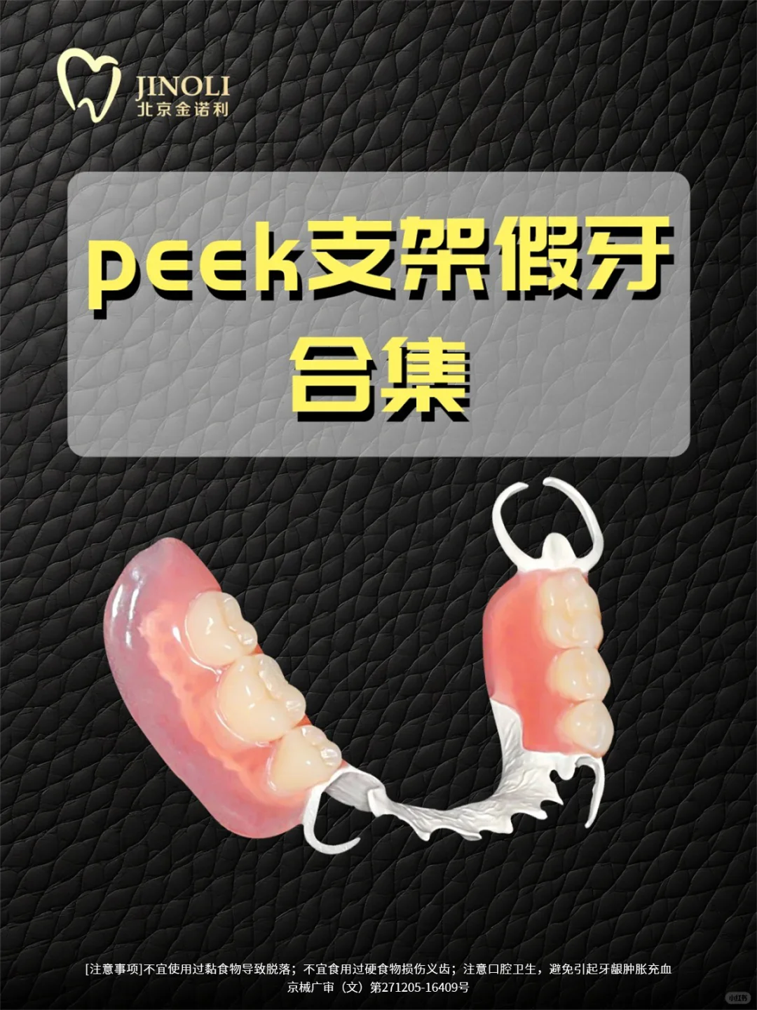 支架假牙中的战斗机-peek支架假牙!