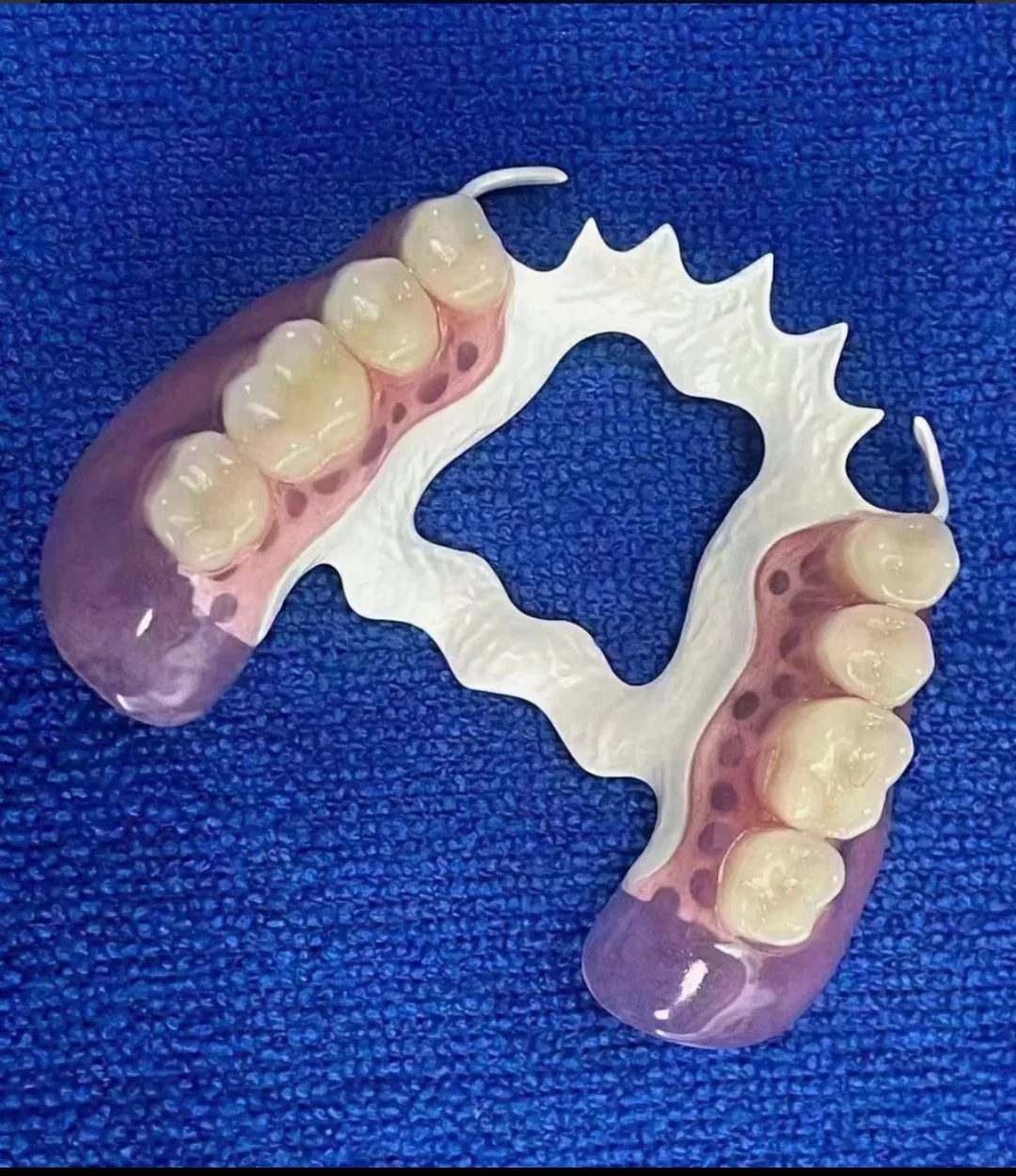 3、?假牙也有“高定版”？更轻、更稳、更高级！