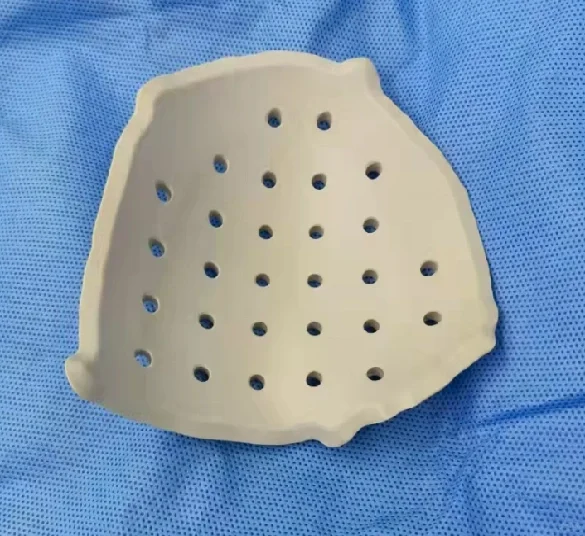 开颅手术及PEEK颅骨修补手术有哪些并发症？