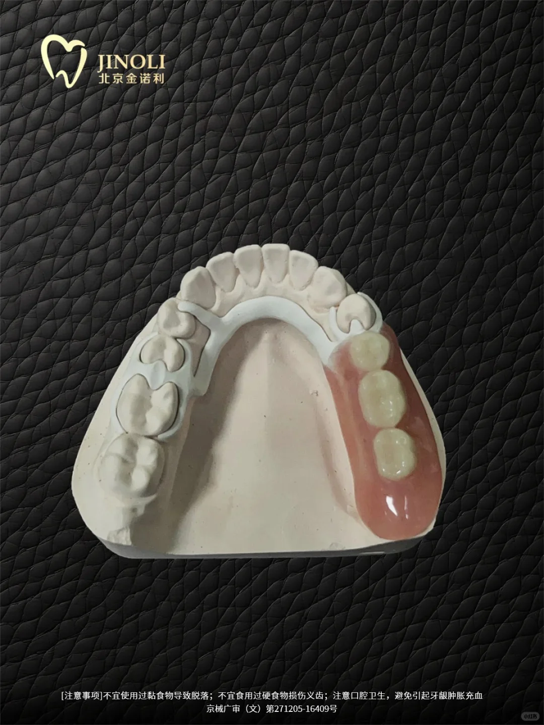 支架假牙中的战斗机-peek支架假牙!