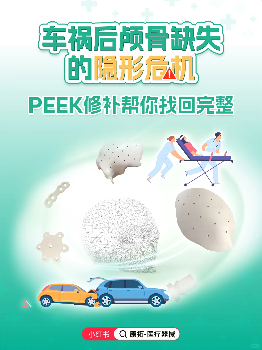 车祸后颅骨缺失藏危机？PEEK修补来帮忙！