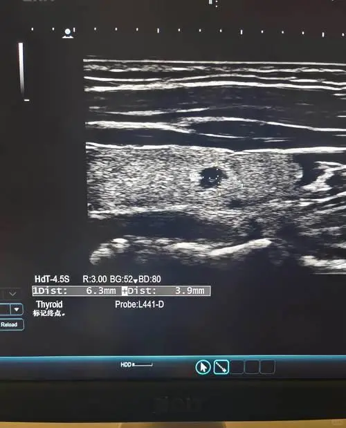 别再被体检套餐“套路”！每年体检该查什么