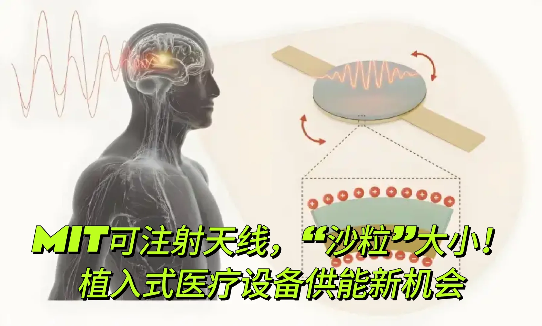 MIT打造全球蕞小可注射天线!重塑植入式医疗