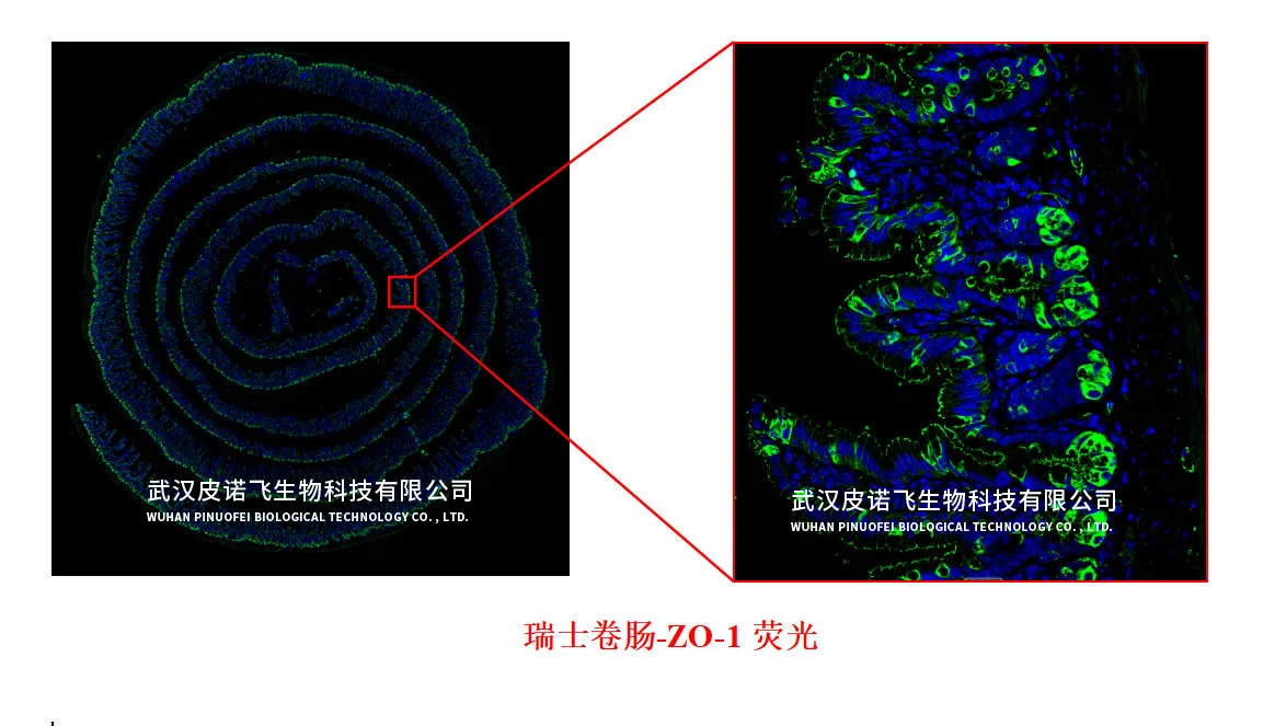 小鼠肠道#瑞士卷肠制作+肠道常见染色效果图